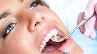 Гигиена полости рта, лечение или удаление зубов в клинике Sun Clinic