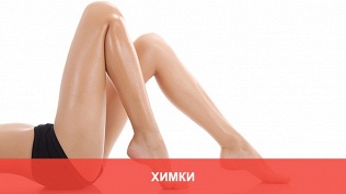 Лазерная эпиляция