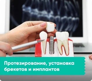 Брекеты