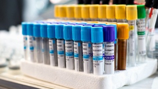 Лаборатория «Литех»: медицинские исследования с выездом на дом