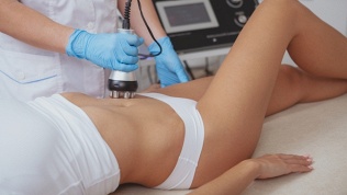 Коррекция фигуры в студии красоты «ЛиЛа»