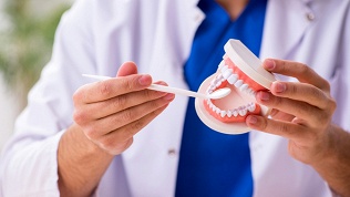 Установка зубного имплантата в стоматологической клинике Smile Secret