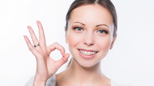 Установка брекет-системы в клинике «Голливуд Дентал»