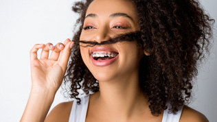 Установка брекет-системы в стоматологическом центре «Врачи улыбок»