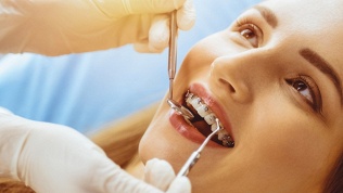 Чистка зубов по системе AirFlow, лечение кариеса в центре «Верамед»