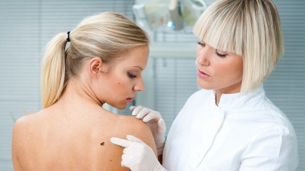 

Удаление новообразований в медцентре Damas Clinic
