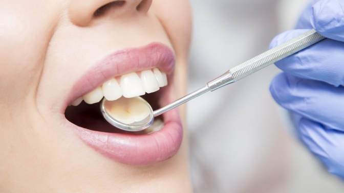 отбеливание зубов стоматология уфа