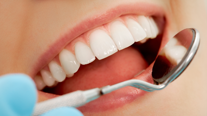 Чистка зубов