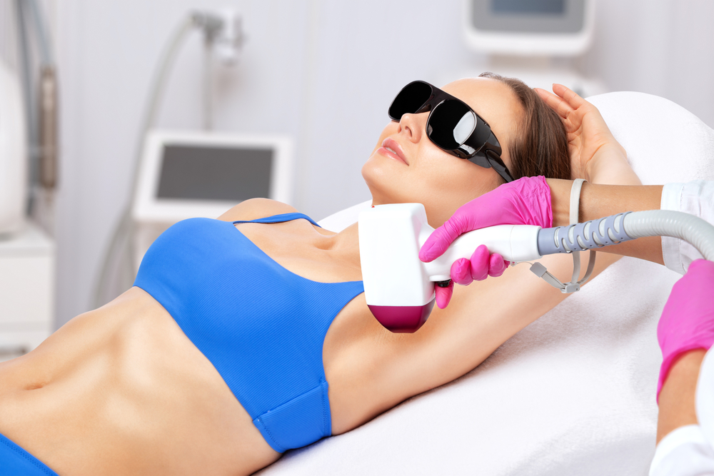 Лазерная эпиляция