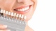 Косметическое отбеливание зубов White & Smile